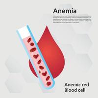 anemia cantidad de sangre roja deficiencia de hierro anemia diferencia de anemia cantidad de glóbulos rojos y síntomas normales ilustración vectorial médica. vector