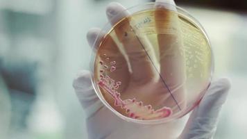 una única colonia visible de bacterias que crecen en una placa de agar video