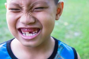 Boy with missing tooth photo