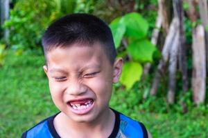 Boy smiling with missing tooth photo