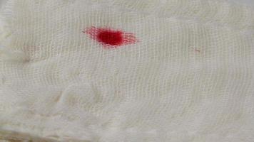 Blood Drops on Gauze Bandage video