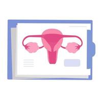 adherencias uterinas. síntoma del síndrome de Asherman. infertilidad femenina. vector