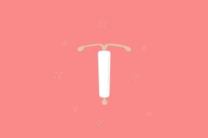 Vector illustration of IUD contraception