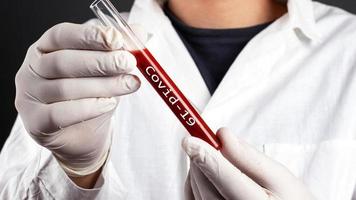 Doctor holds test tube with blood infected with covid-19 virus photo