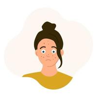 Sad teenage girl with acne on her face, transition age, problem skin, rash. vector