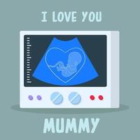 Ultrasound of a baby that expresses the love he feels for his mother vector