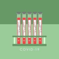 Pruebas de laboratorio para detectar coronavirus en el vector. vector