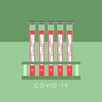 LABORATORY TESTS FOR DETECTING CORONAVIRUS IN THE VECTOR