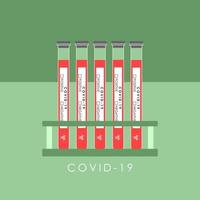 LABORATORY TESTS FOR DETECTING CORONAVIRUS IN THE VECTOR