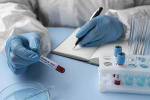 Doctor with blood samples making a medical report photo