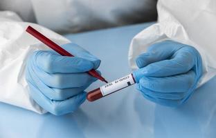 Hand with protective gloves holding a blood sample for covid test photo