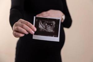 Cropped image of young pregnant woman holding ultrasound picture on belly Concept of pregnancy photo