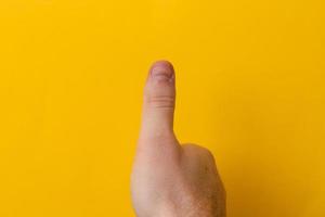 Fingers with bitten nails isolated on a yellow background photo