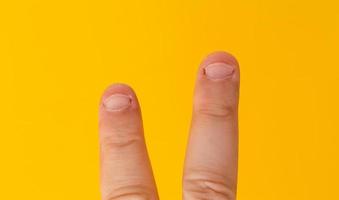 Two fingers with bitten nails isolated on a yellow background photo