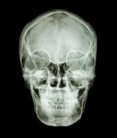 film x ray skull AP  show normal asian human s skull    Thai people photo