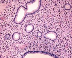 Endometrium Proliferative phase photo