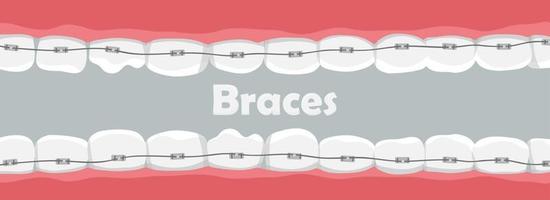 pancarta con dientes con tirantes vector