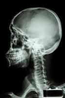 Radiografía de película cráneo humano y columna cervical foto