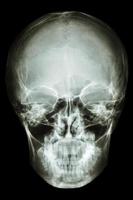 film x ray asian people s skull Thai people photo