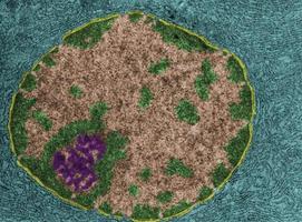 Nucleus and nucleolus False colour TEM photo