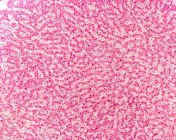 Human liver micrograph photo
