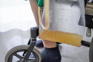 Señora asiática paciente mujer sentada en silla de ruedas con bolsa de orina en la sala del hospital concepto médico saludable