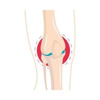 rheumatism knee swelling vector