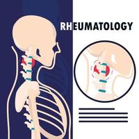 reumatología esqueleto humano vector