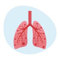 Sick lungs with covid 19 coronavirus vector