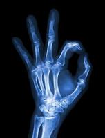 X ray hand with OK symbol photo