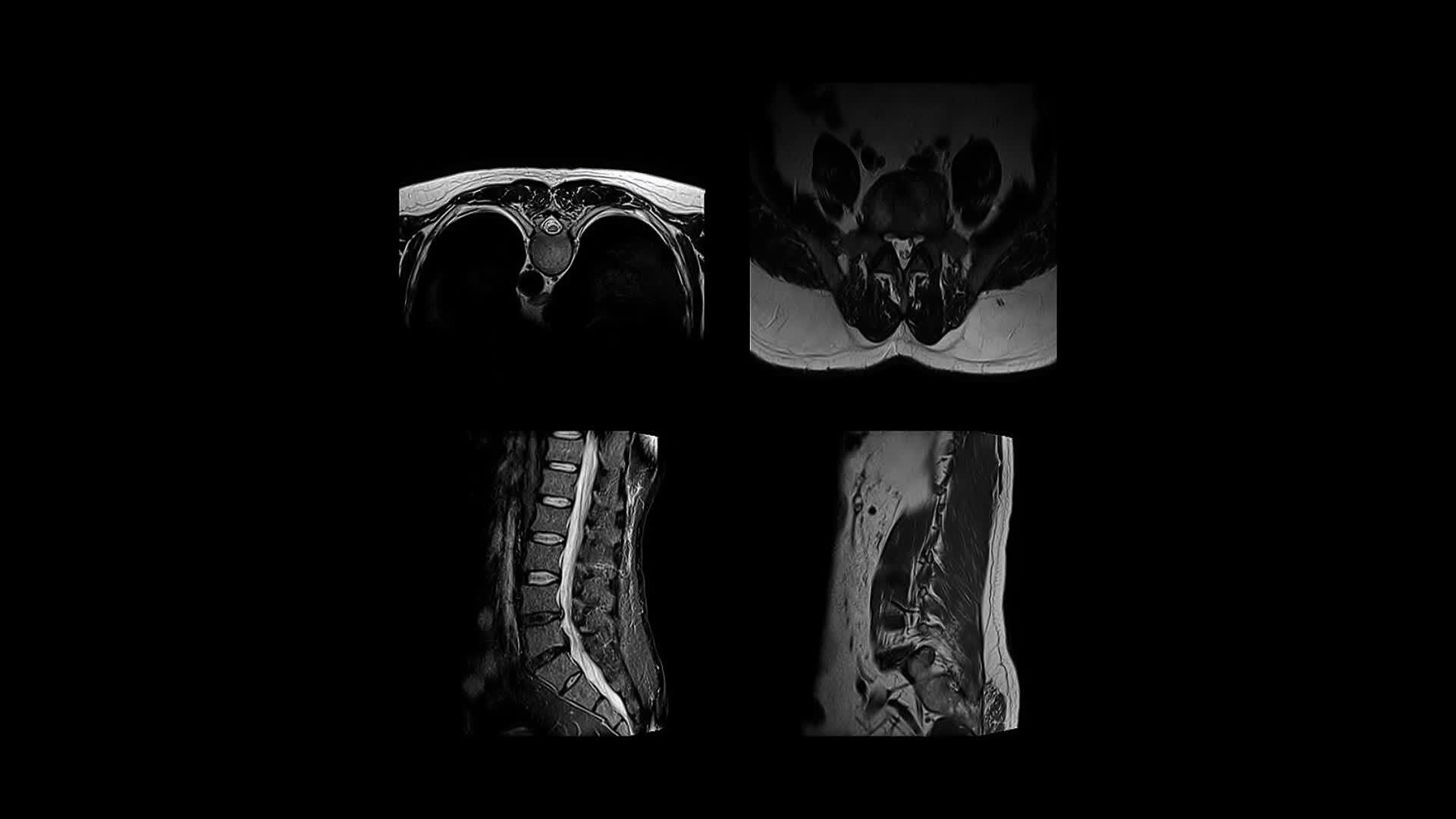 MRI close up monochrome images scan organs of different parts of the ... Biology Diagrams