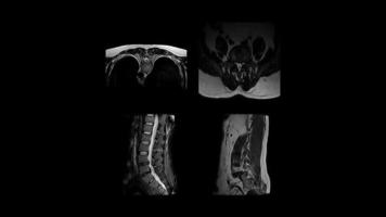 ressonância magnética close-up imagens monocromáticas escanear órgãos de diferentes partes do corpo humano video