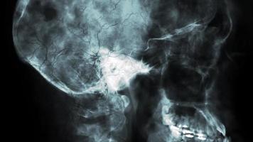 radiografía lateral del cráneo humano o investigación del cerebro video