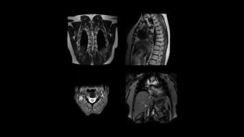 resonancia magnética de cerca imágenes monocromas escanear órganos de diferentes partes del cuerpo humano