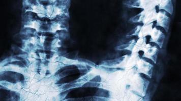 radiografía de huesos humanos o investigación médica video