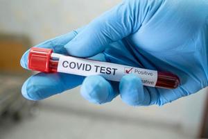 Positive blood infection sample in test tube for covid 19 coronavirus in lab photo