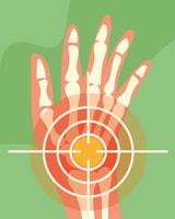 rheumatology hand bones vector