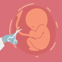 cutting the umbilical cord vector