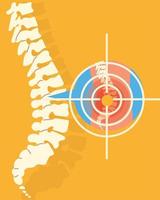 rheumatology spine bones vector