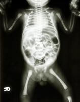 Película de rayos x muestran el esqueleto normal del bebé foto