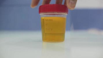 tecnico di laboratorio ispeziona un contenitore di urina video