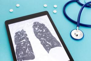 Tablet computer with Lung X-ray and stethoscope and pills on blue background. Lung diseases concept photo