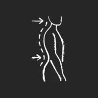 Lumbar lordosis chalk white icon on black background. Excessive inward spine curve. Saddleback appearance. Pain, discomfort. Difficulty with coordination. Isolated vector chalkboard illustration