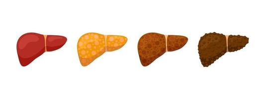 Fatty Liver Vector Art, Icons, and Graphics for Free Download