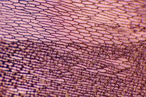 epidermis de cebolla con células grandes pigmentadas foto