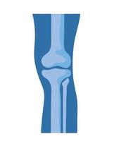 huesos normales de la rodilla