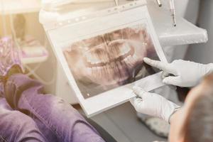 un médico ortodoncista le muestra al niño una radiografía de los dientes.