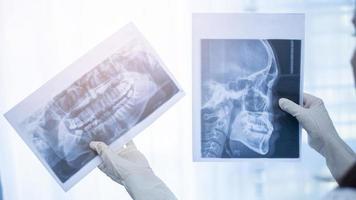 dentista mujer sosteniendo una radiografía dental foto