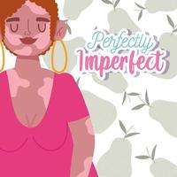 perfectamente imperfecto, mujer de dibujos animados con pelo rizado y vitiligo en el cuerpo vector