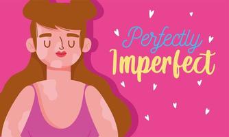 perfectly imperfect, cartoon woman with vitiligo disease vector